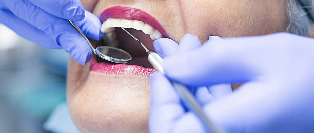 Best Broken or Chipped Tooth Repair in Fruitland, ID